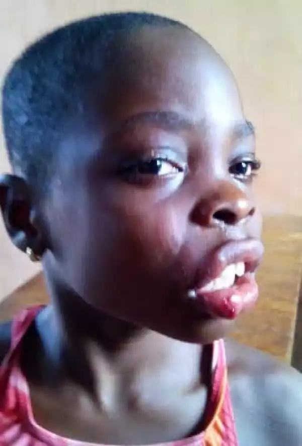 So Bad!! See What Mother Did To Her Own Child In Benin [See Photos]